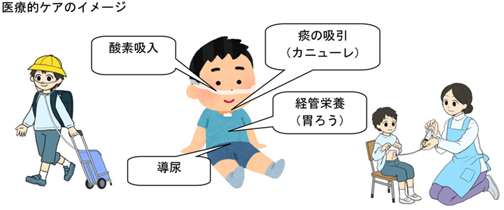 医療的ケアのイメージ